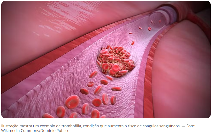 DIPIRONA E PARACETAMOL CONTRA DENGUE: QUAIS CUIDADOS TOMAR AO BUSCAR REMÉDIOS PARA SINTOMAS DA DOENÇA